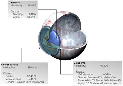 Epigenetics in the Eye: An Overview of the Most Relevant Ocular Diseases